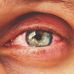 eye theory medical eye care