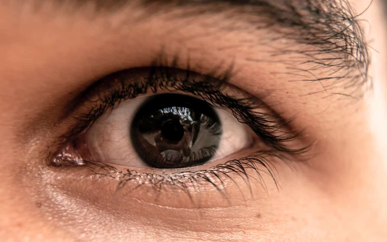 Blepharitis and Dry Eye Disease