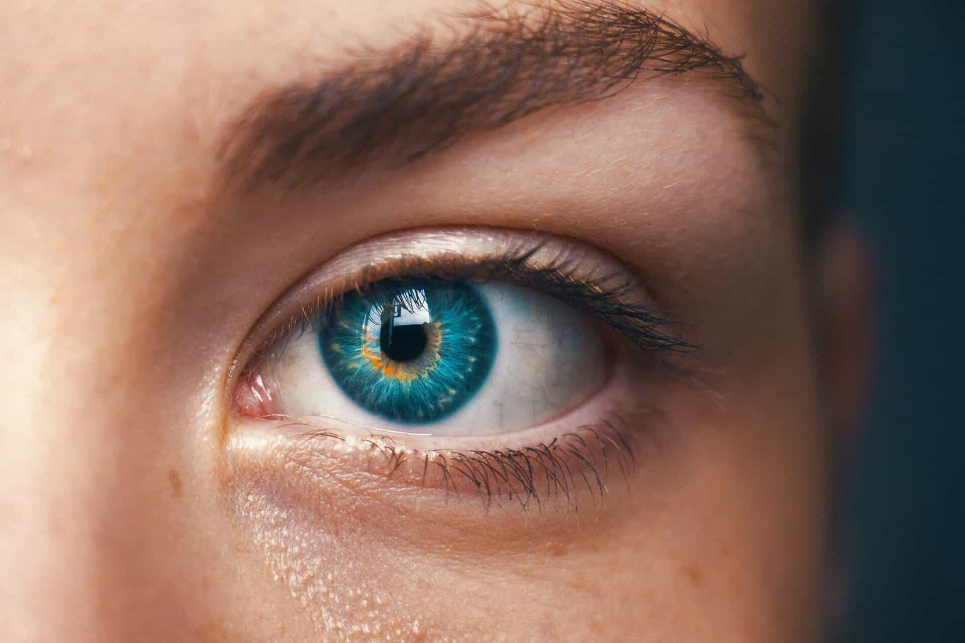 glaucoma, blue eye