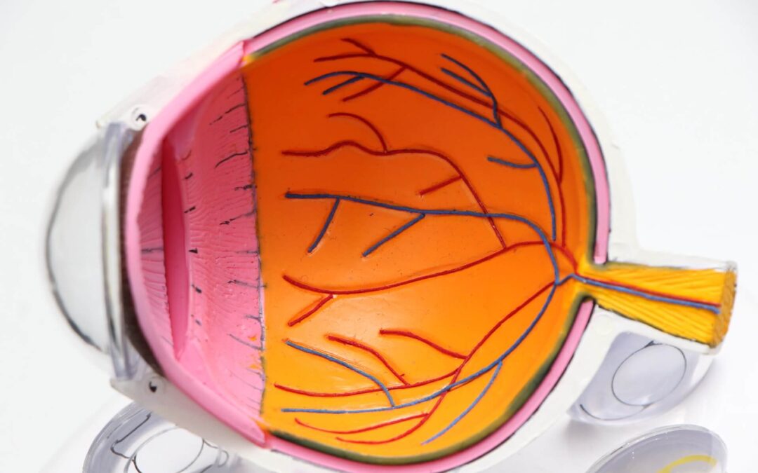 What is the Link Between Multiple Sclerosis and Optic Neuritis?