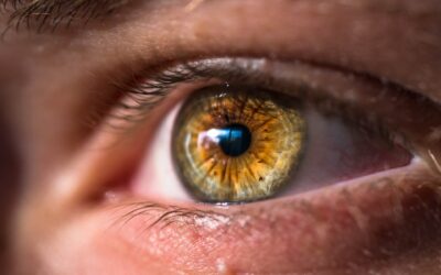 What are Dry Eye Flare Ups and How are They Treated?