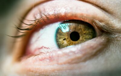 How Long Does Blurred Vision Last After a Corneal Abrasion