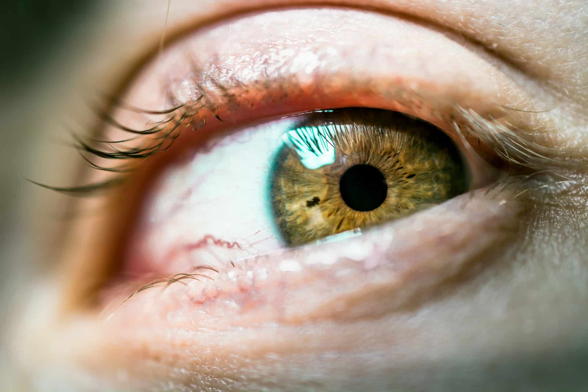 from this image we explore how long does blurred vision last after a corneal abrasion